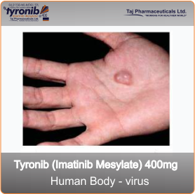 Drug information and side-effects for Tyronib (imatinib mesylate)